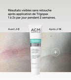 ACM Trigopax Soin Protecteur et Apaisant 75 g