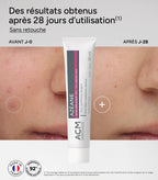 ACM Azéane Crème 15% Acide Azélaïque  30 ml