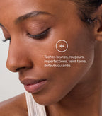 ACM Azéane Crème 15% Acide Azélaïque  30 ml