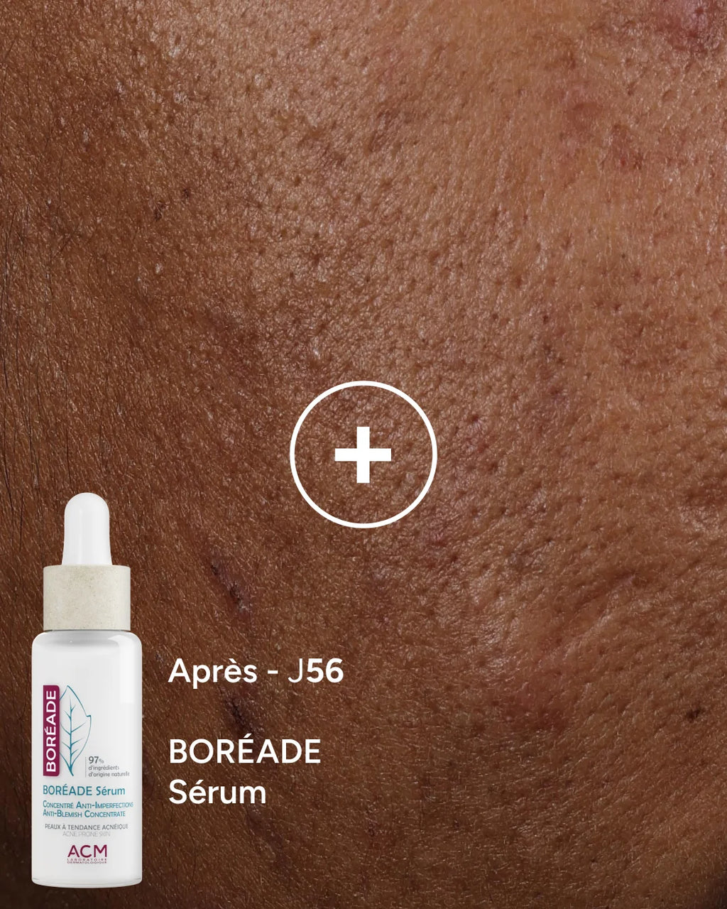 ACM Boréade Sérum 30 ml