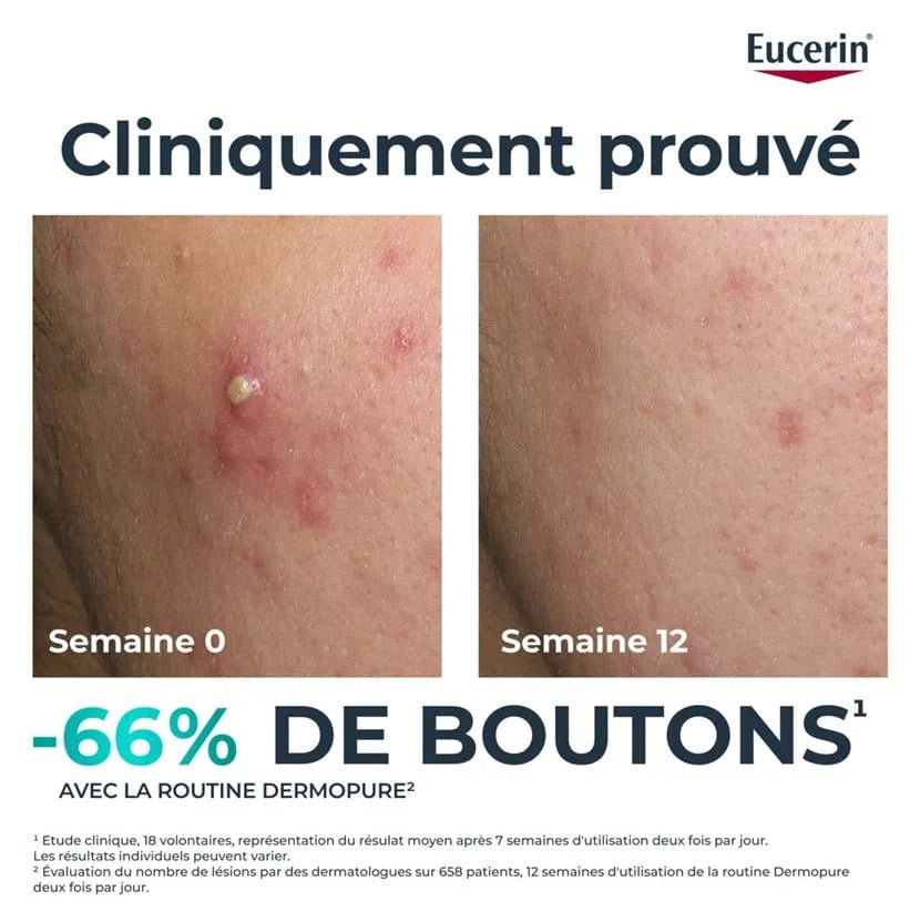 Eucerin DERMOPURE CLINICAL TRIPLE ACTION Peau grasse à tendance acnéique